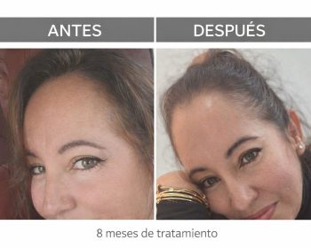 be-beauty-lanzarote-clublanzarote