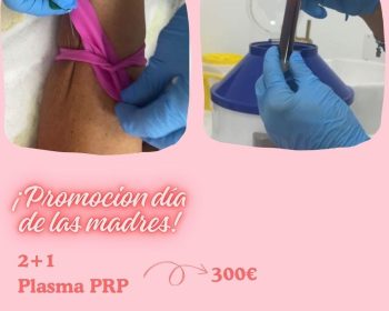 maica-centro-médico-estético-costa-teguise-lanzarote-clublanzarote-promo-5